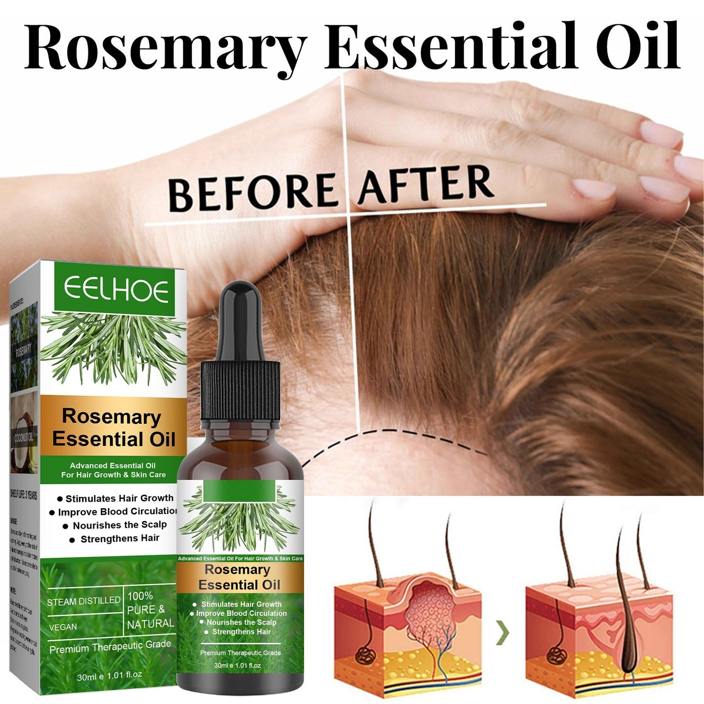 EELHOE GrowThrive™ Rosemary Hair Oil