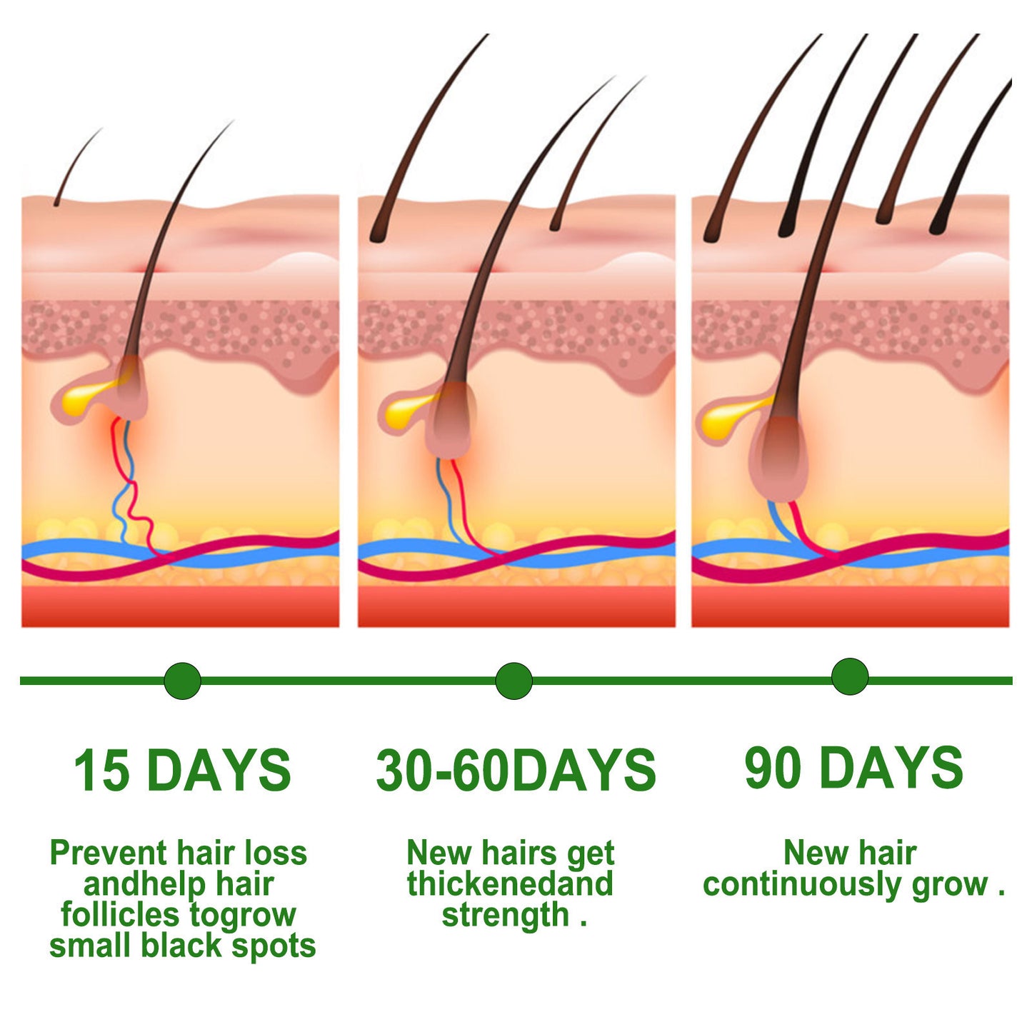 EELHOE GrowThrive™ Rosemary Hair Oil