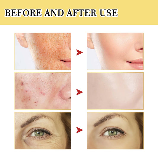 Ouhoe SnailGlow™ Collagen Repair Facial Serum