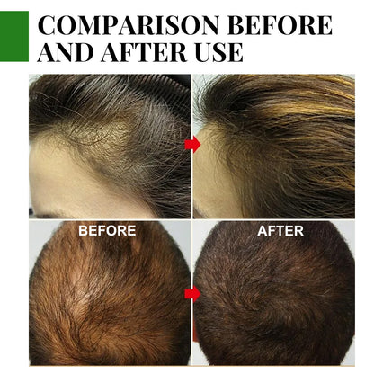 EELHOE GrowThrive™ Rosemary Hair Oil